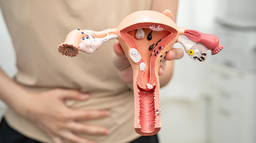 Menstrual Disorders | Petals Health