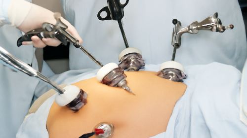 Minor Surgeries | Petals Health