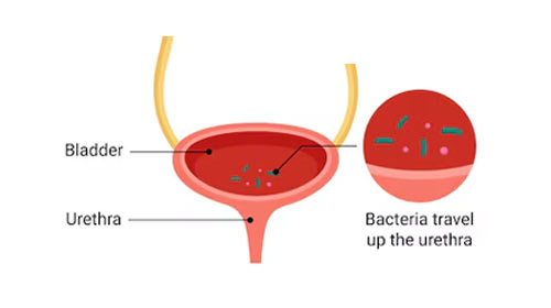 STIs & UTIs | Petals Health